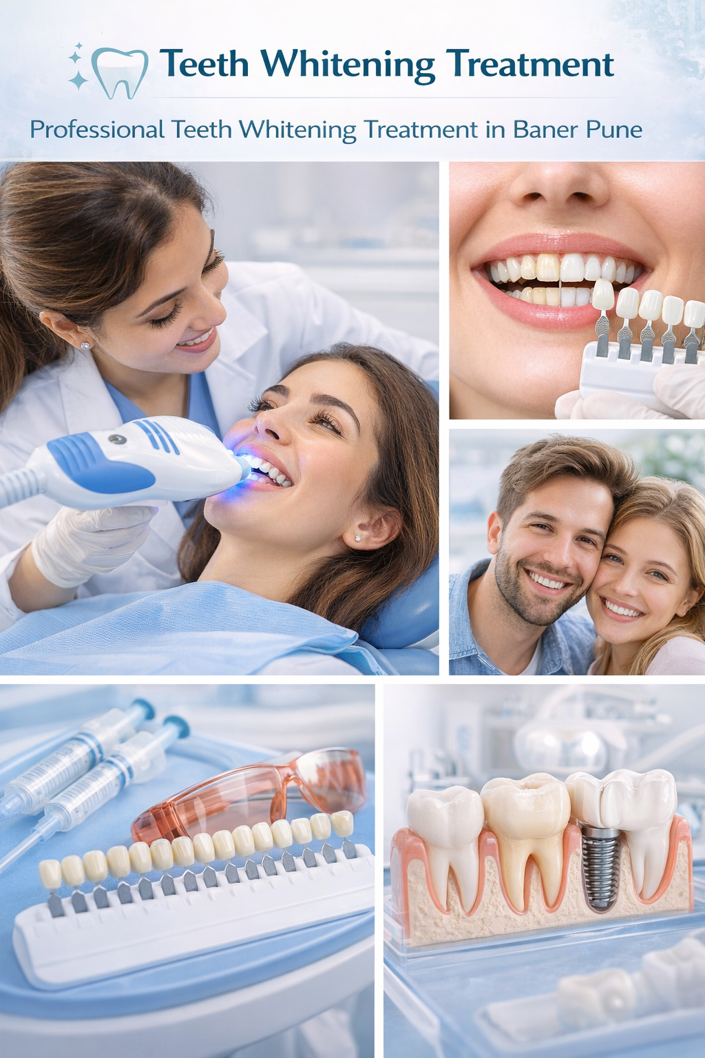 Professional Teeth Bleaching in Baner Gaon